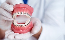 dentist holding traditional braces in hand 